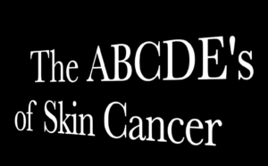 Read more about the article The A, B, C, D, E’s of Skin Cancer