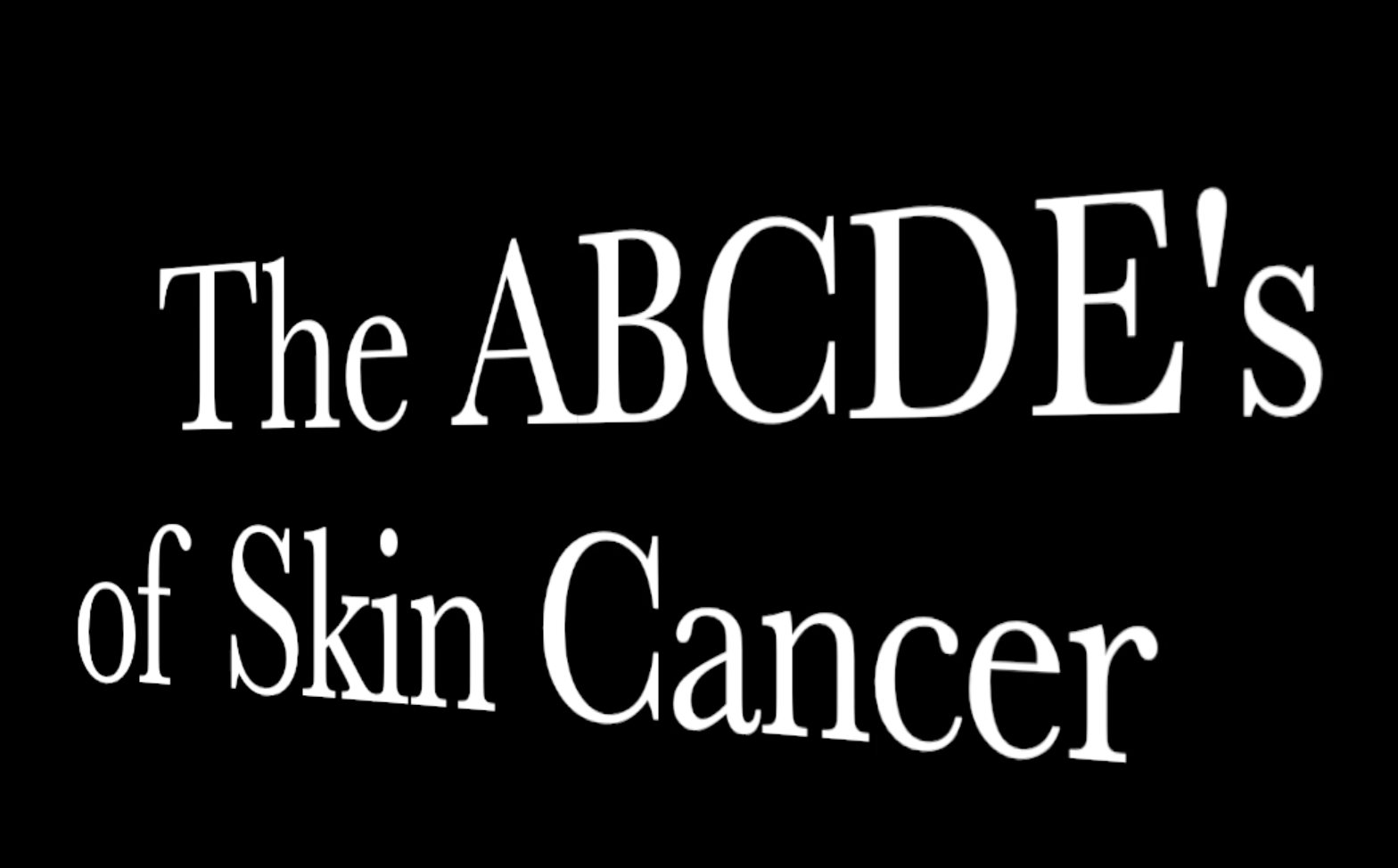 You are currently viewing The A, B, C, D, E’s of Skin Cancer